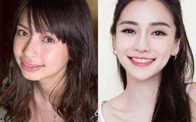 龅牙娱乐吃瓜,揭秘娱乐圈吃瓜背后的真相与笑料